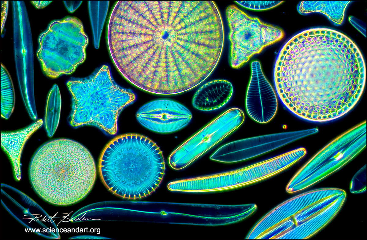 reshwater Diatoms photographed with the Olympus E microscope and Darkfield illumination Robert Berdan 