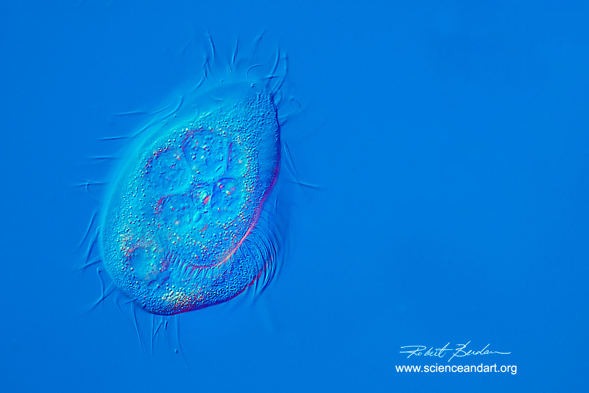 Phacodinium metchnikoffi a ciliate found in moss - Differential interference microscopy (DIC) 400X Robert Berdan ©