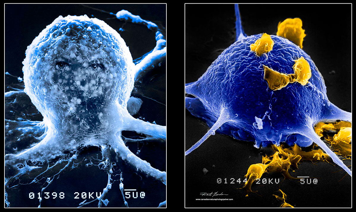 Scanning electron micrographs of single isolated neurons in culture by Robert Berdan 